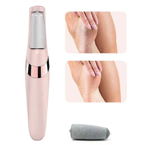 Electric Pedicure Foot File – Callus Remover for Smooth Feet